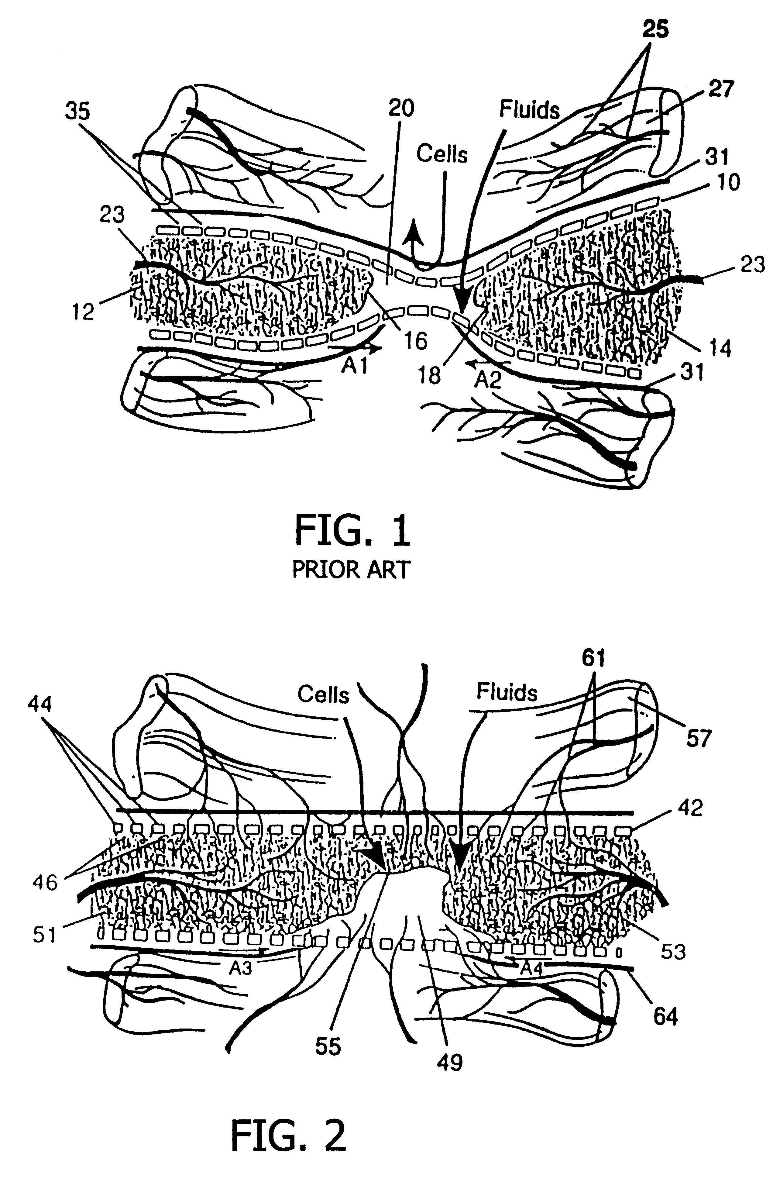 Resorbable, macro-porous non-collapsing and flexible membrane barrier for skeletal repair and regeneration