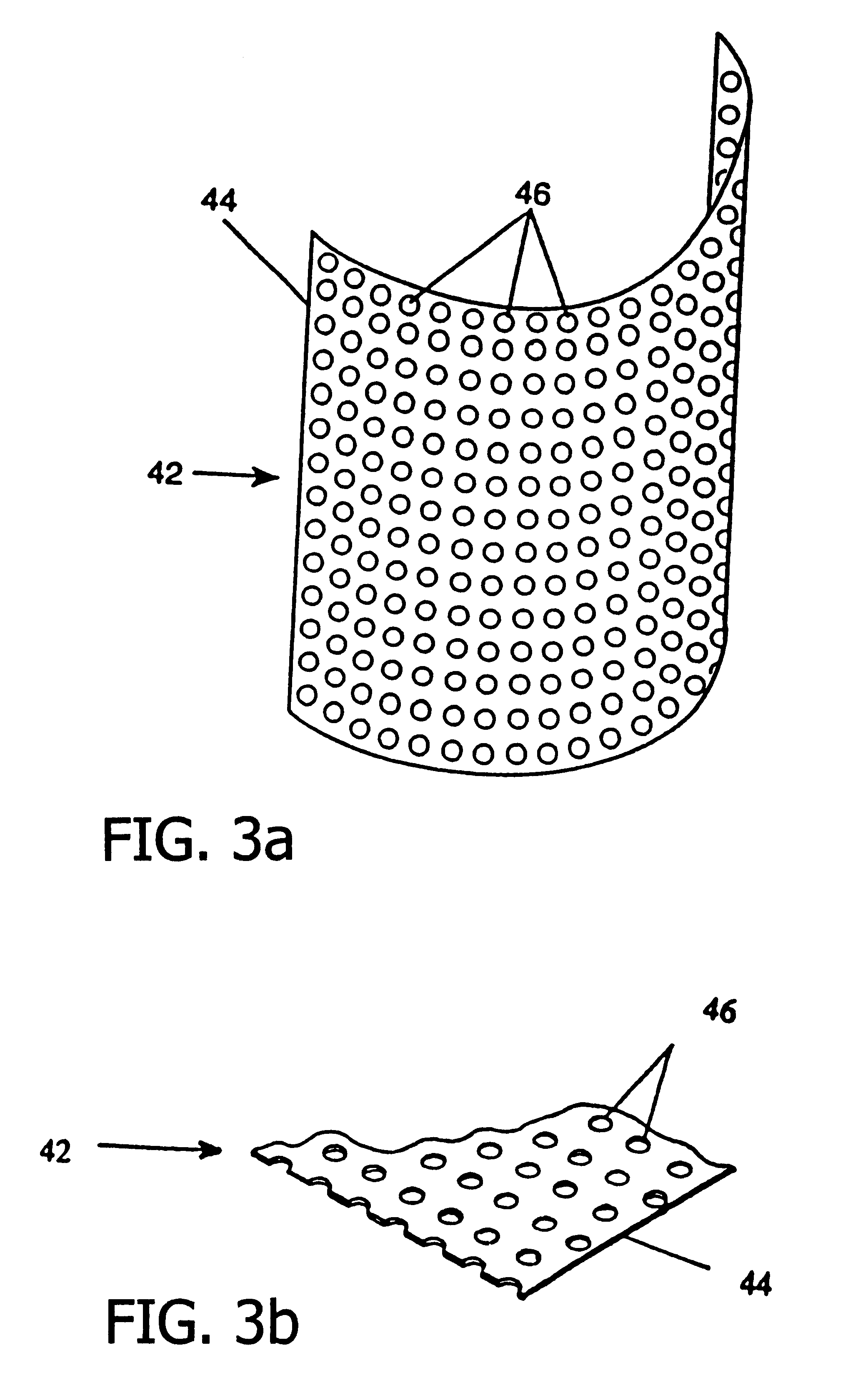 Resorbable, macro-porous non-collapsing and flexible membrane barrier for skeletal repair and regeneration