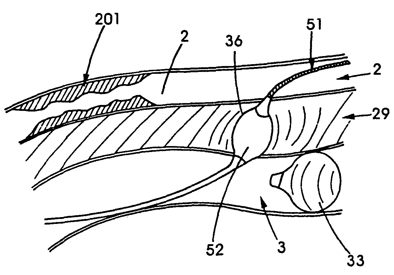 Device, system and method for interstitial transvascular intervention