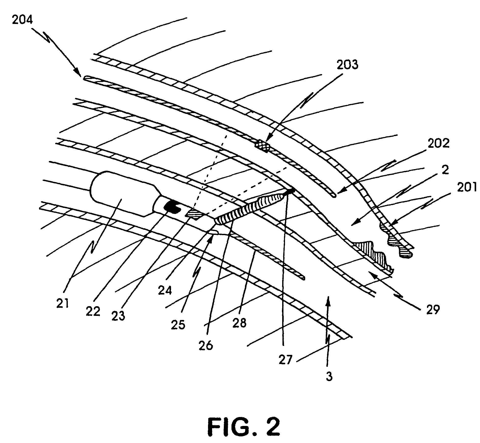 Device, system and method for interstitial transvascular intervention