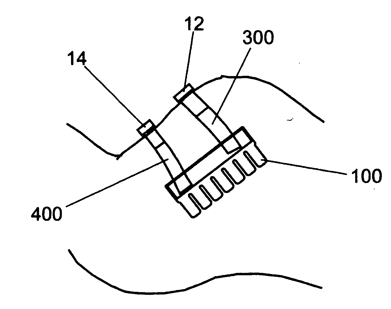 System, method, and kit for positioning a monitor transducer on a patient