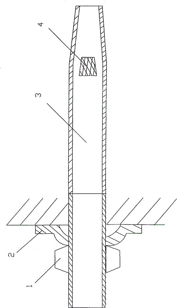 pre-anchor catheter