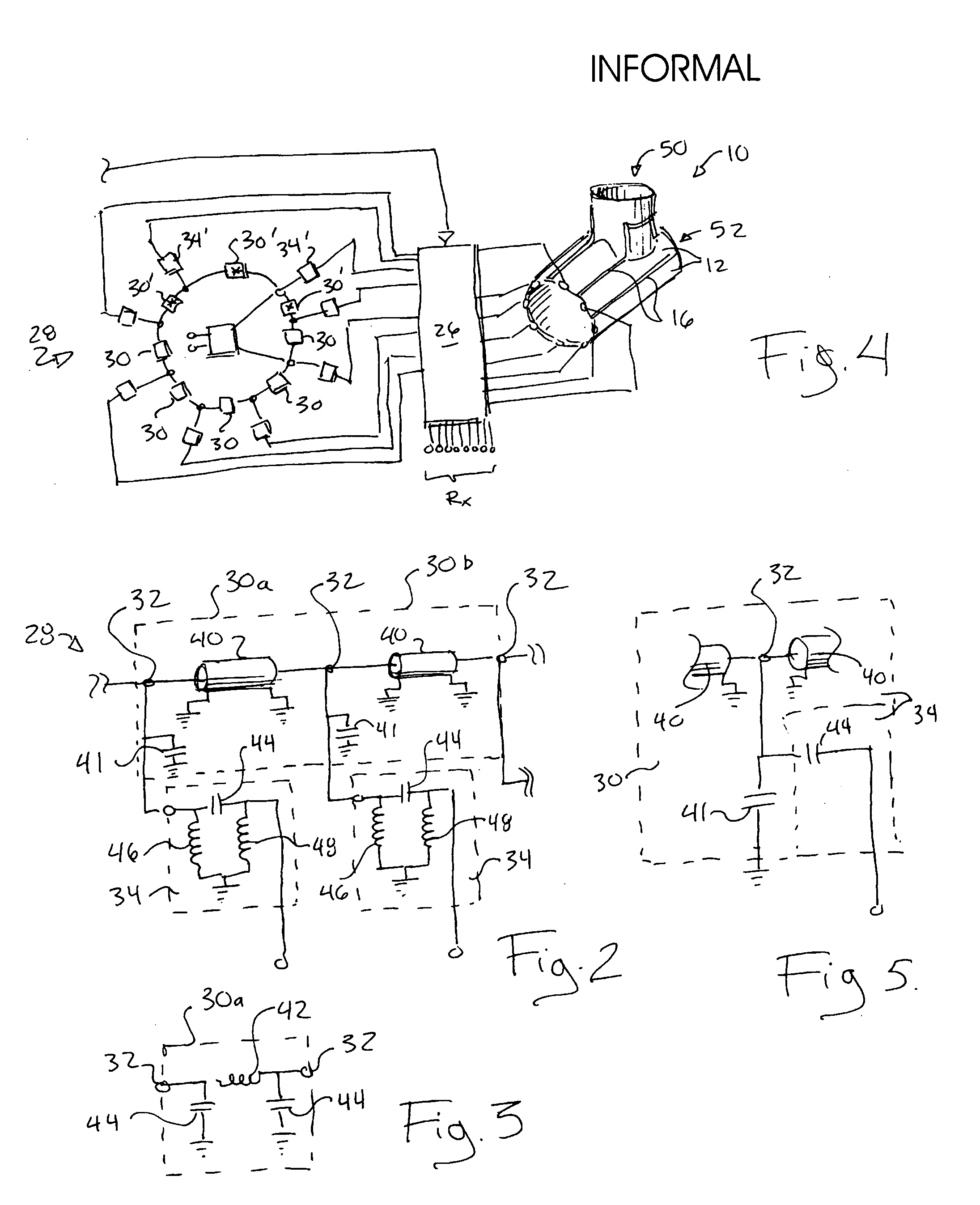 Phased array MRI coil with controllable coupled ring resonator