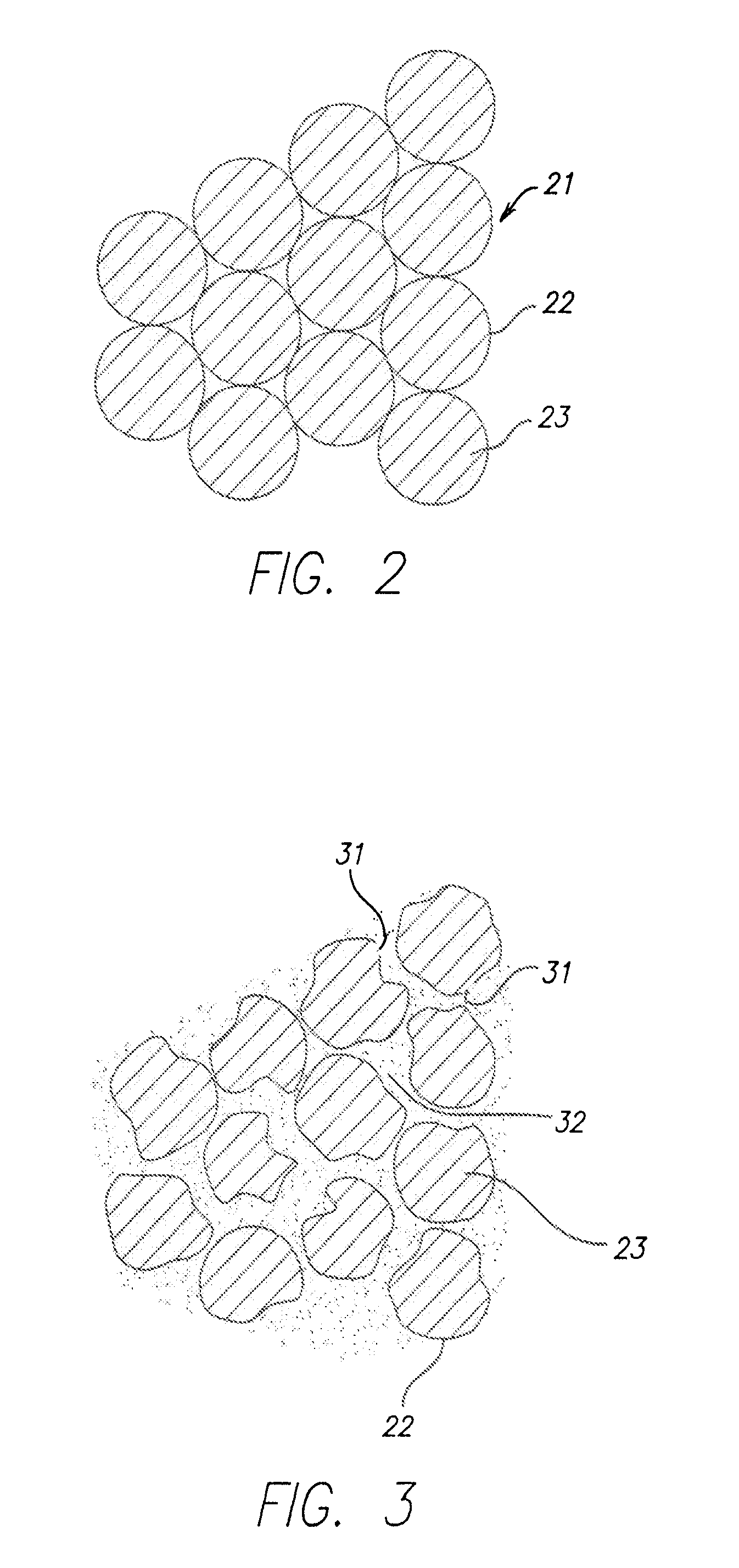 Fat Reduction Using External Laser Radiation and Niacin