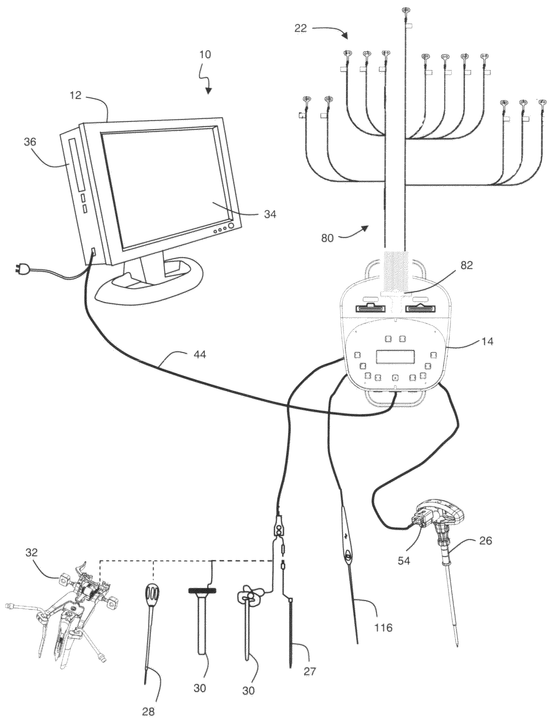 Neurophysiologic monitoring system