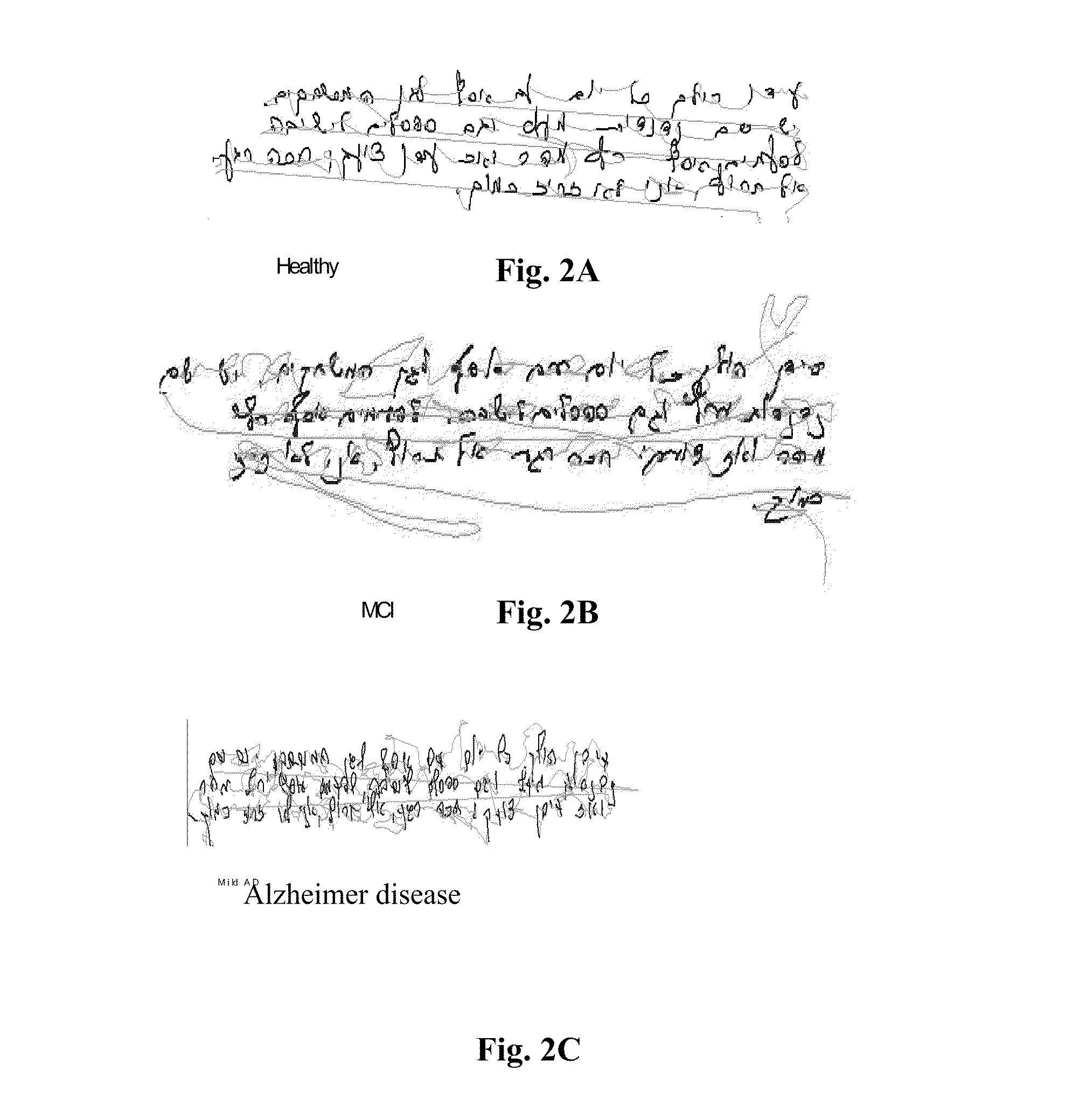 Diagnosis method and system based on handwriting analysis