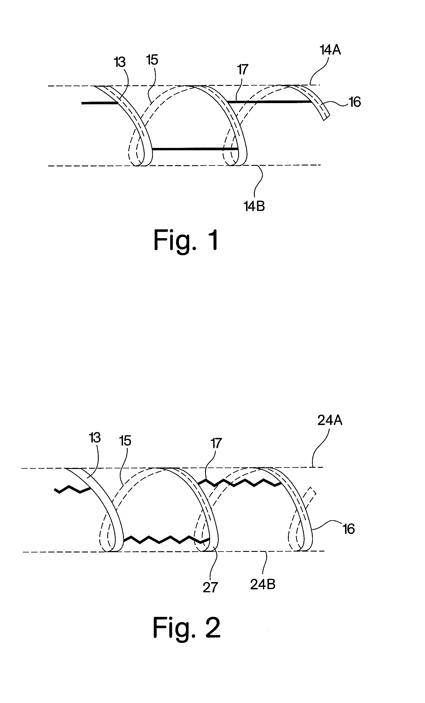 Stent coated with a sustained-release drug delivery and method for use thereof