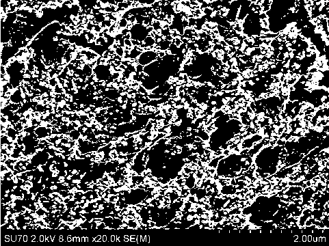 Preparation method of collagen coating embedded with chitosan microspheres on medical metal implant surface