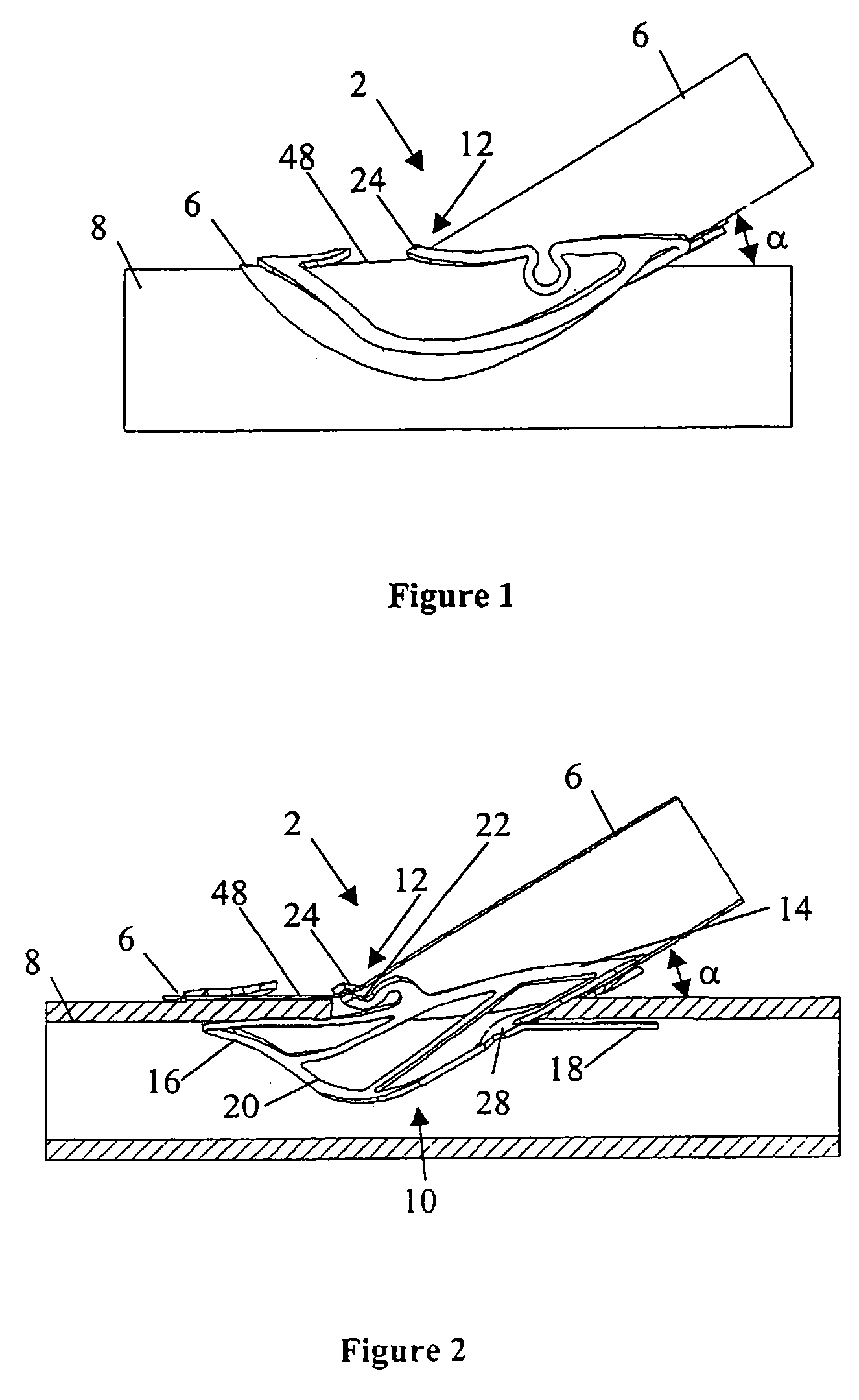 Vascular anastomosis systems