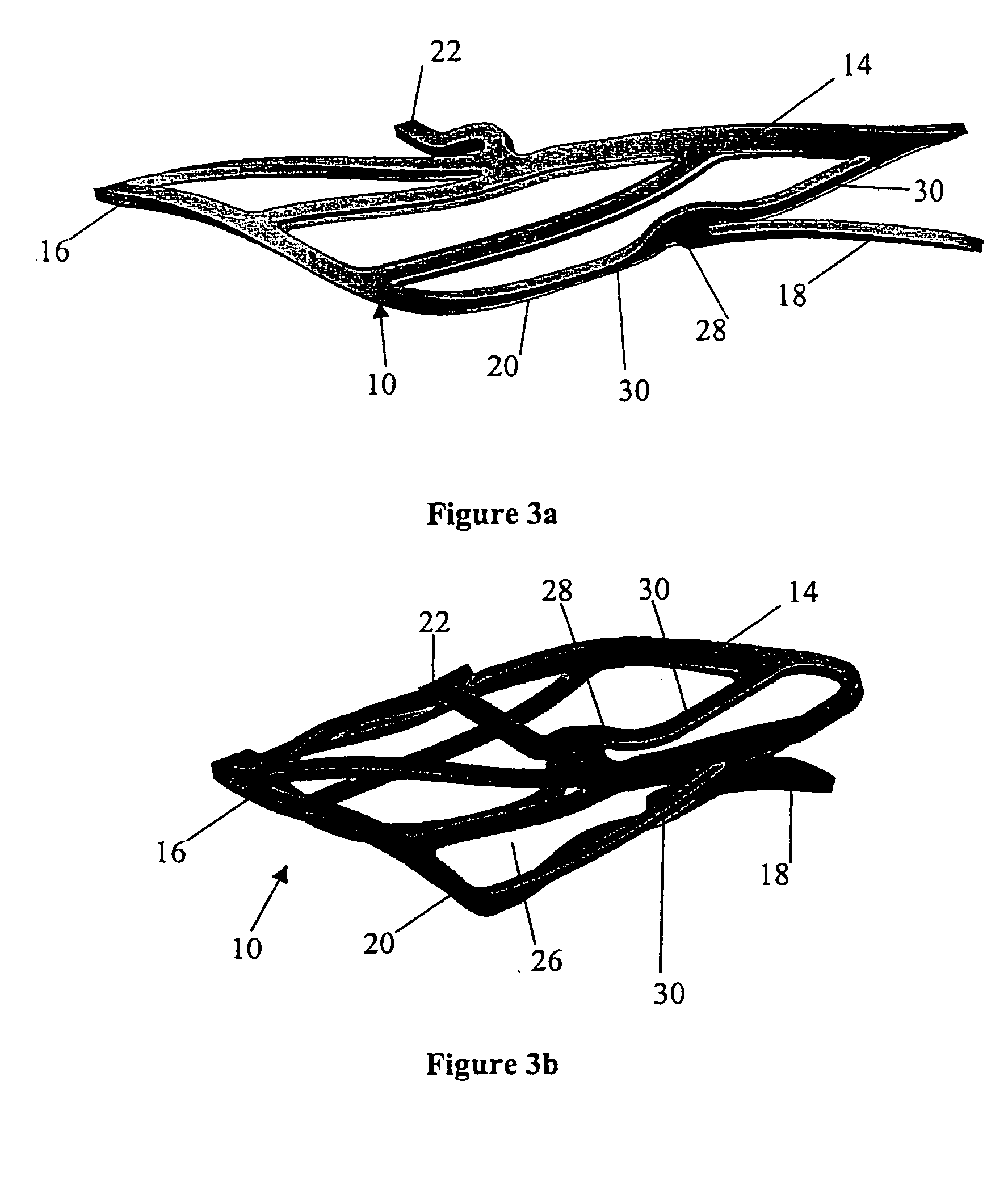 Vascular anastomosis systems