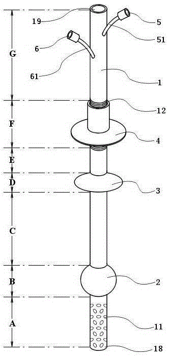 Double-balloon intestine fistulization catheter for preventing anastomotic fistula after colorectal surgery