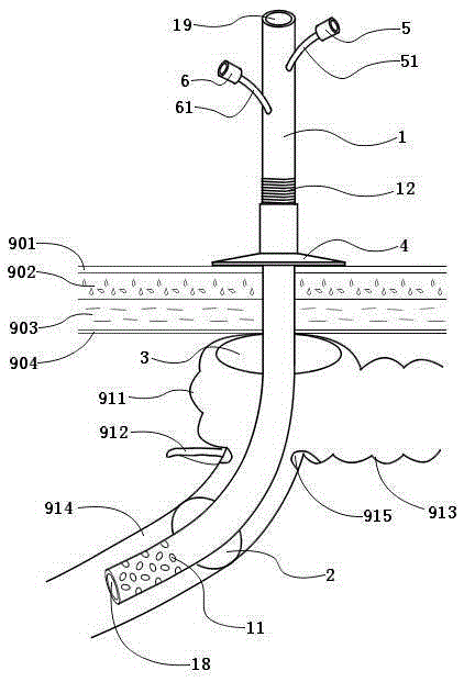 Double-balloon intestine fistulization catheter for preventing anastomotic fistula after colorectal surgery