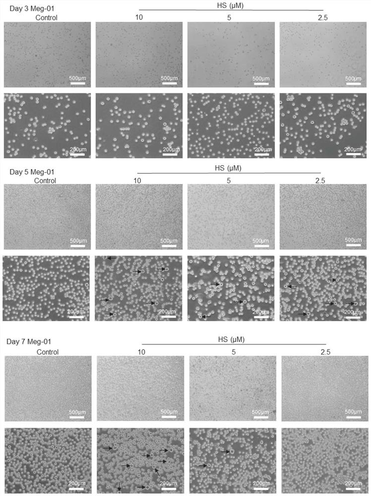 Application of hirsutine in medicine for treating thrombocytopenia