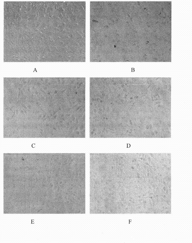 Plant extract of the genus Zanthoxylum and its preparation method and use