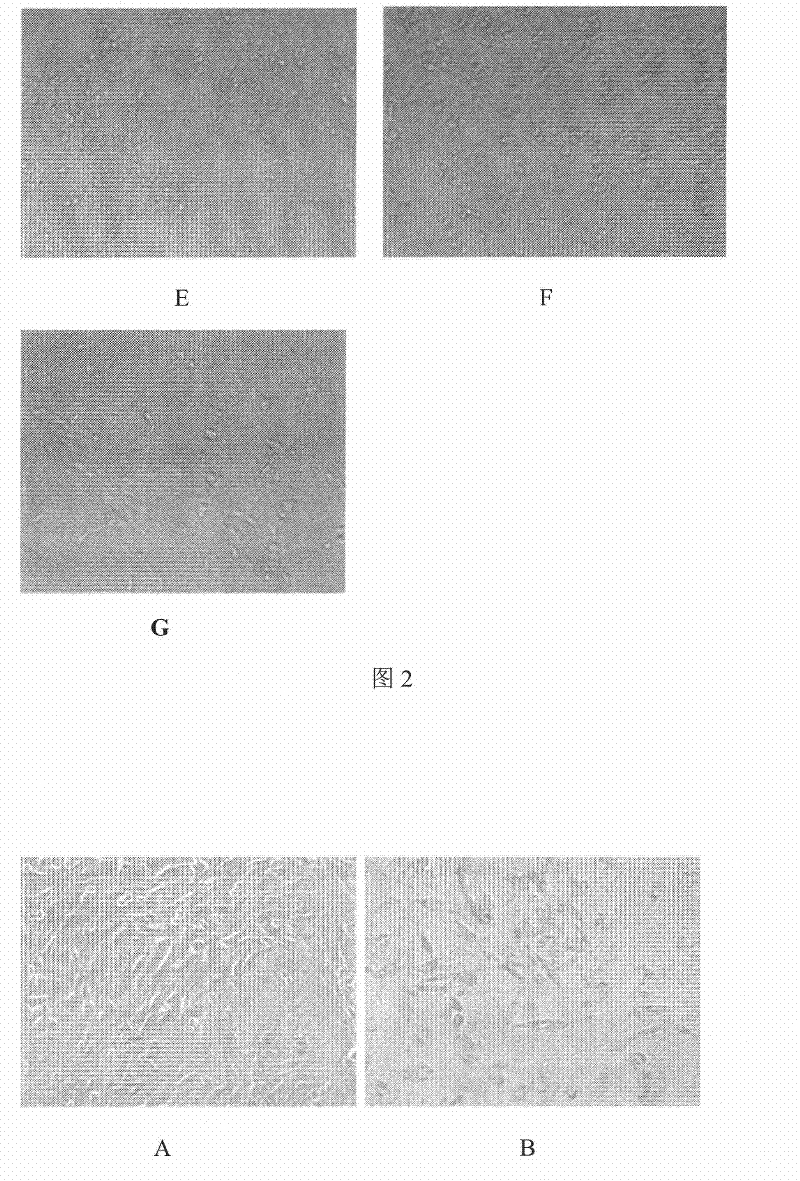 Plant extract of the genus Zanthoxylum and its preparation method and use