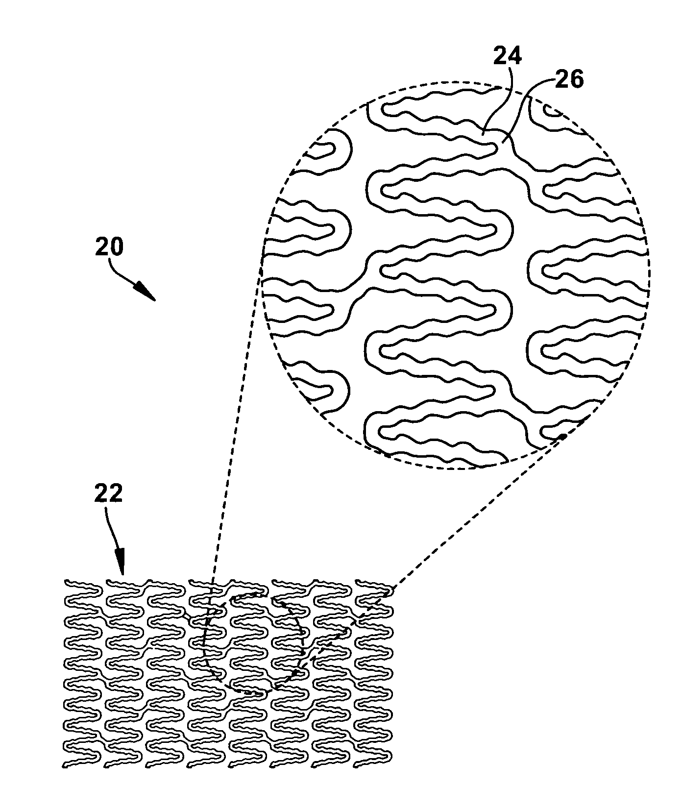 Stent having a bridge structure