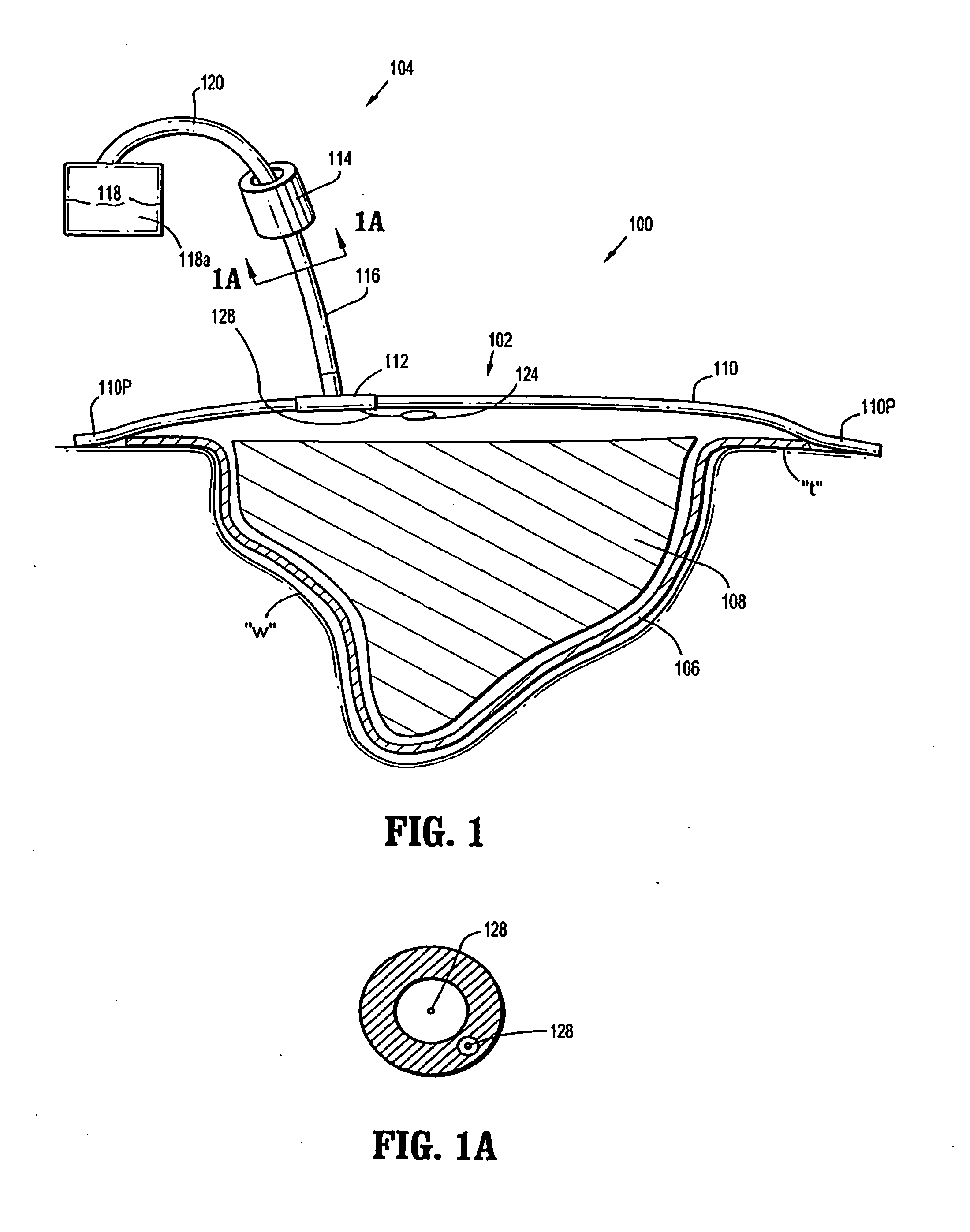 Self contained wound dressing apparatus