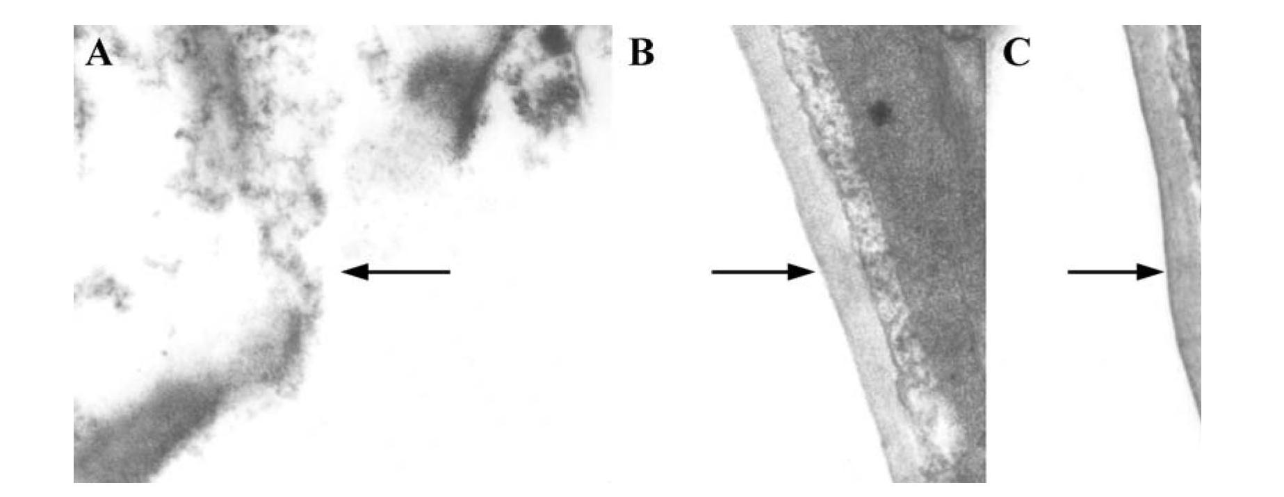 Polygalacturonase PCIPG21 from phytophora capsic, and coding gene and application thereof