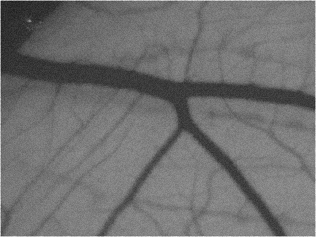 Blood vessel diameter measuring method based on digital image processing technology