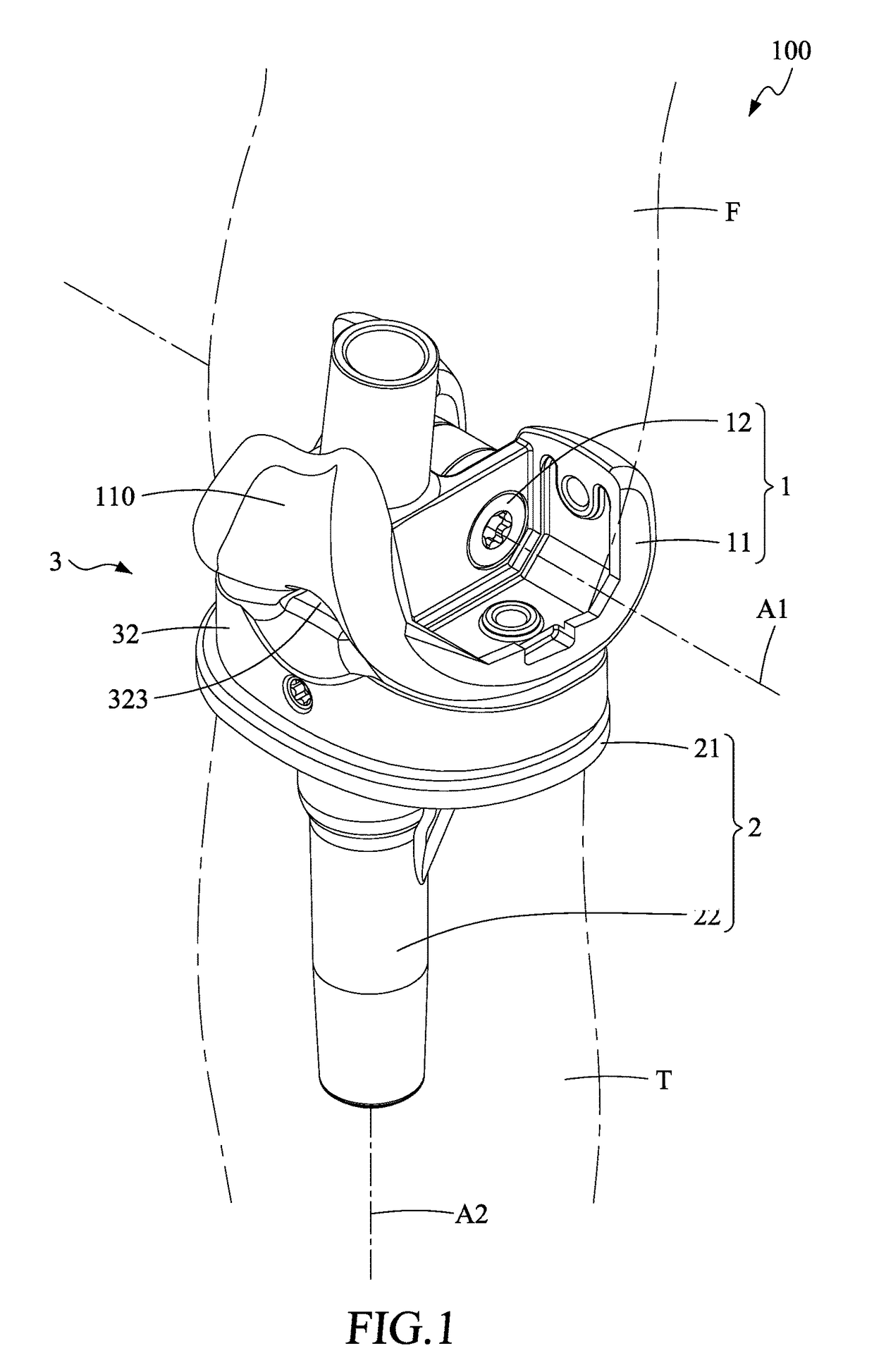 Artificial knee joint