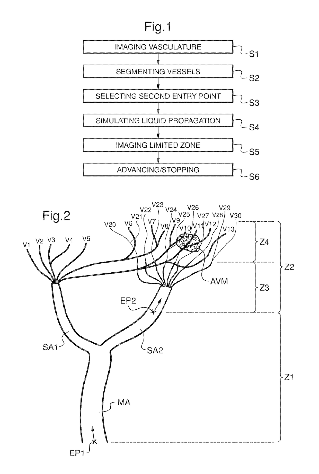 Three dimensional imaging method of a limited zone of a patient's vasculature