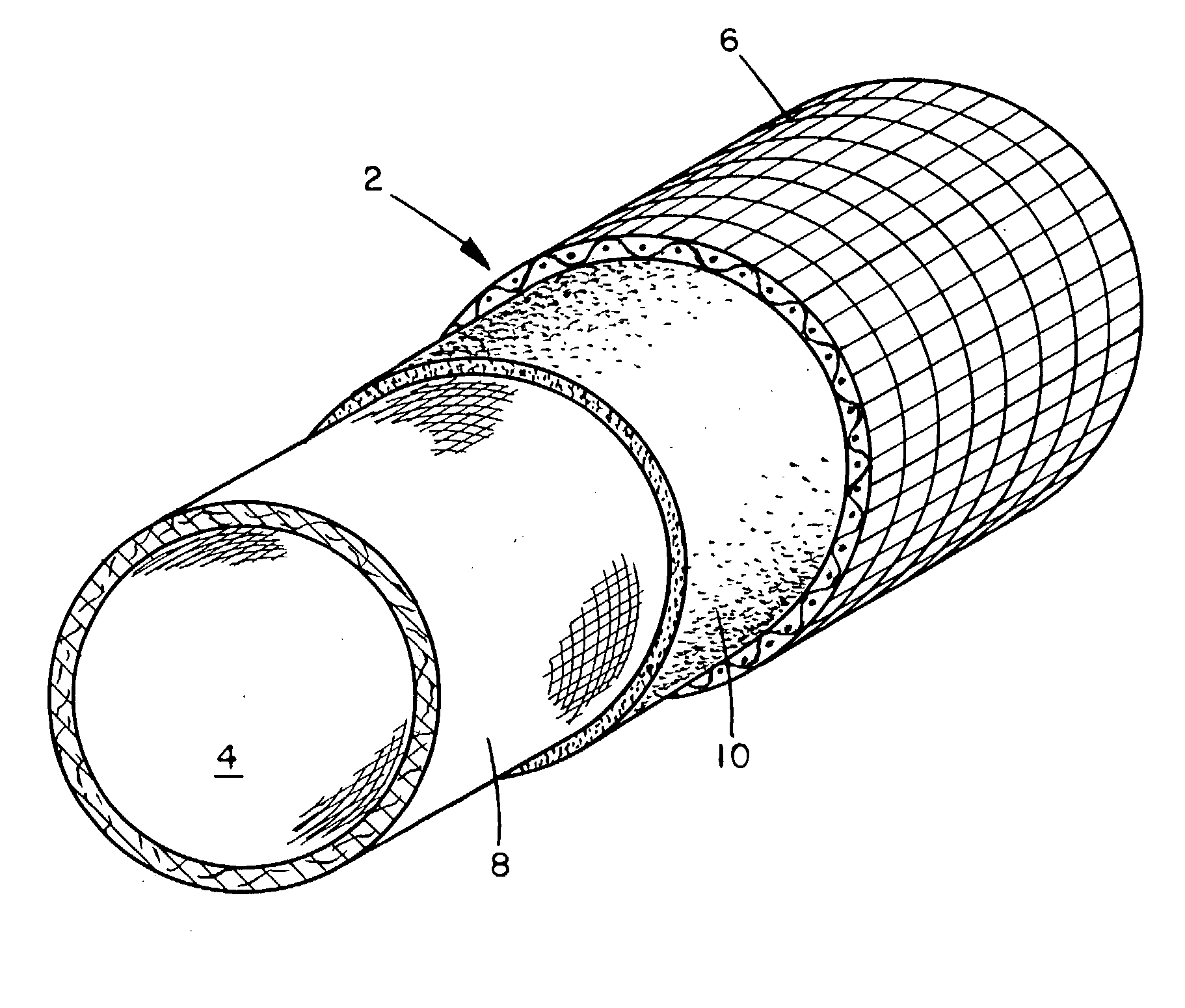 Laminated casing or netting for proteinaceous products