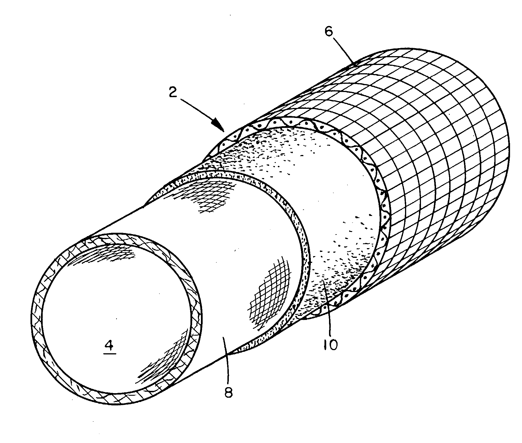 Laminated casing or netting for proteinaceous products