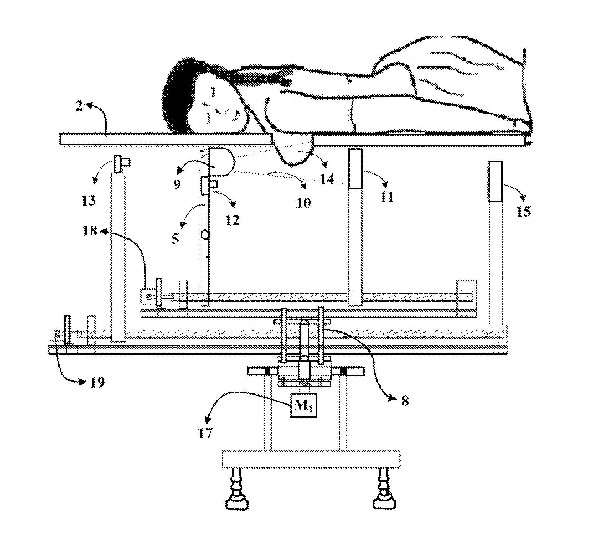 Device with simultaneous x-ray and infrared image acquisition and processing system for enhanced breast imaging