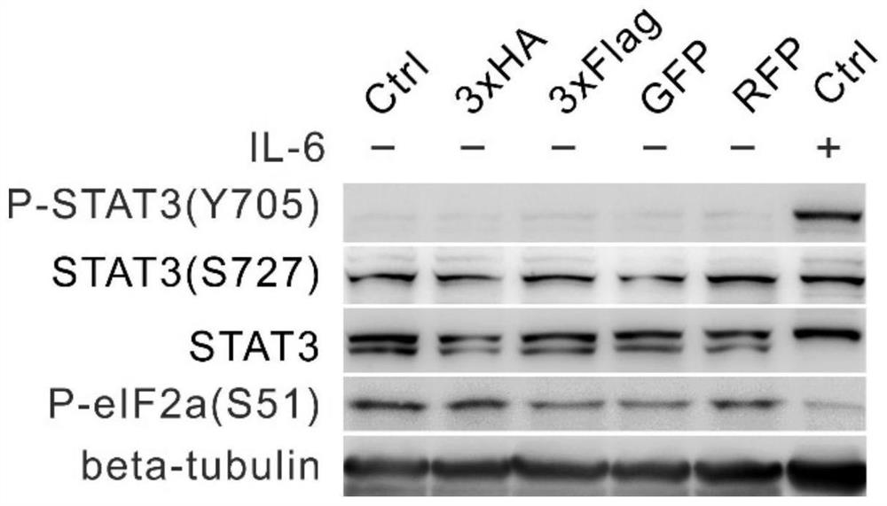 Application of reagent for losing CTTNBP2NL function in preparation of medicine for treating diseases