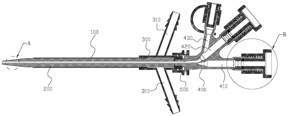 Disposable Percutaneous Nephroscopic Dilatation Sheath