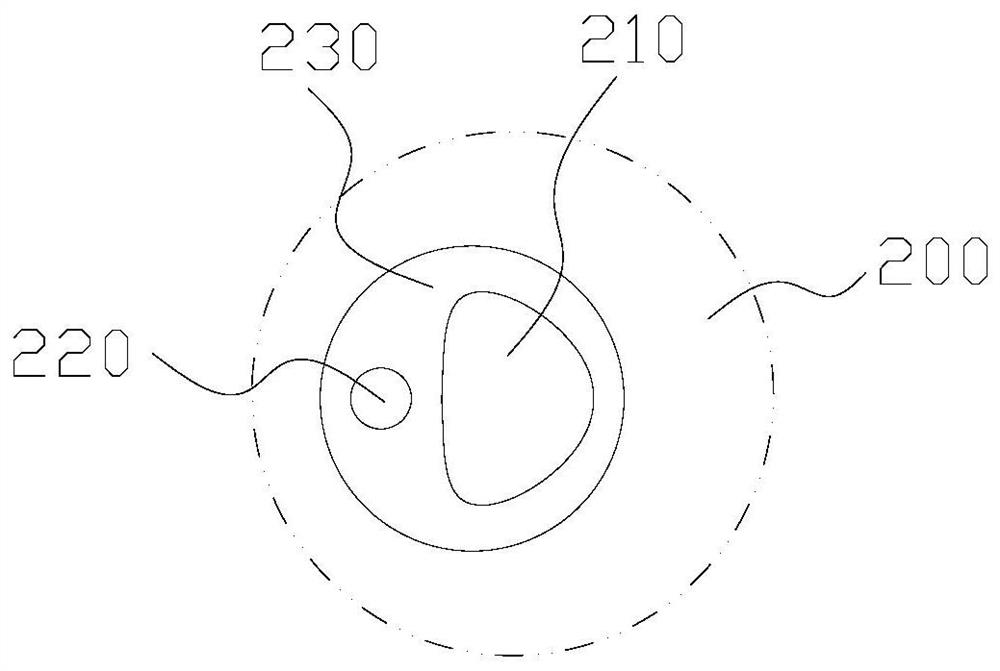 Disposable Percutaneous Nephroscopic Dilatation Sheath