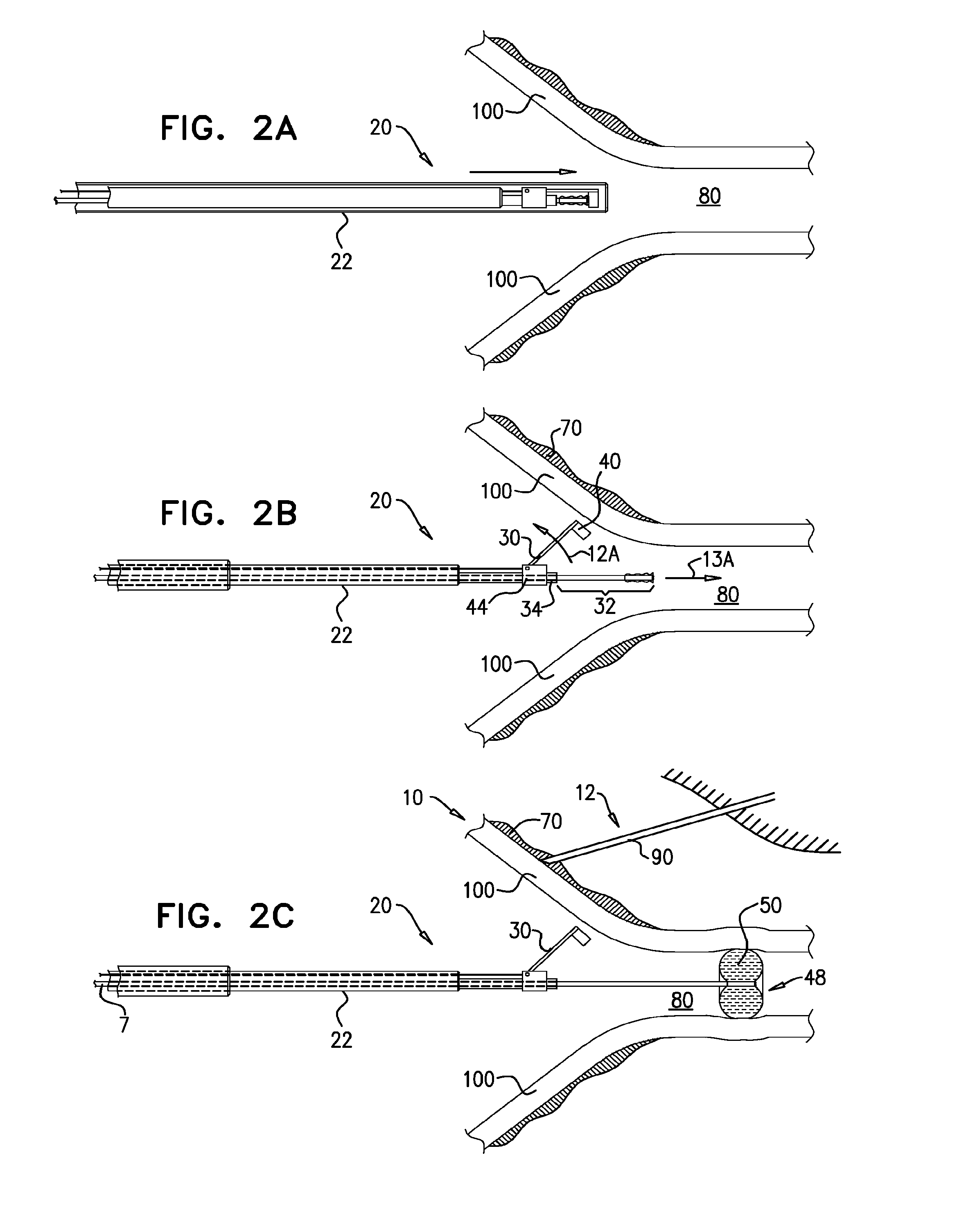 Reflectance-facilitated ultrasound treatment