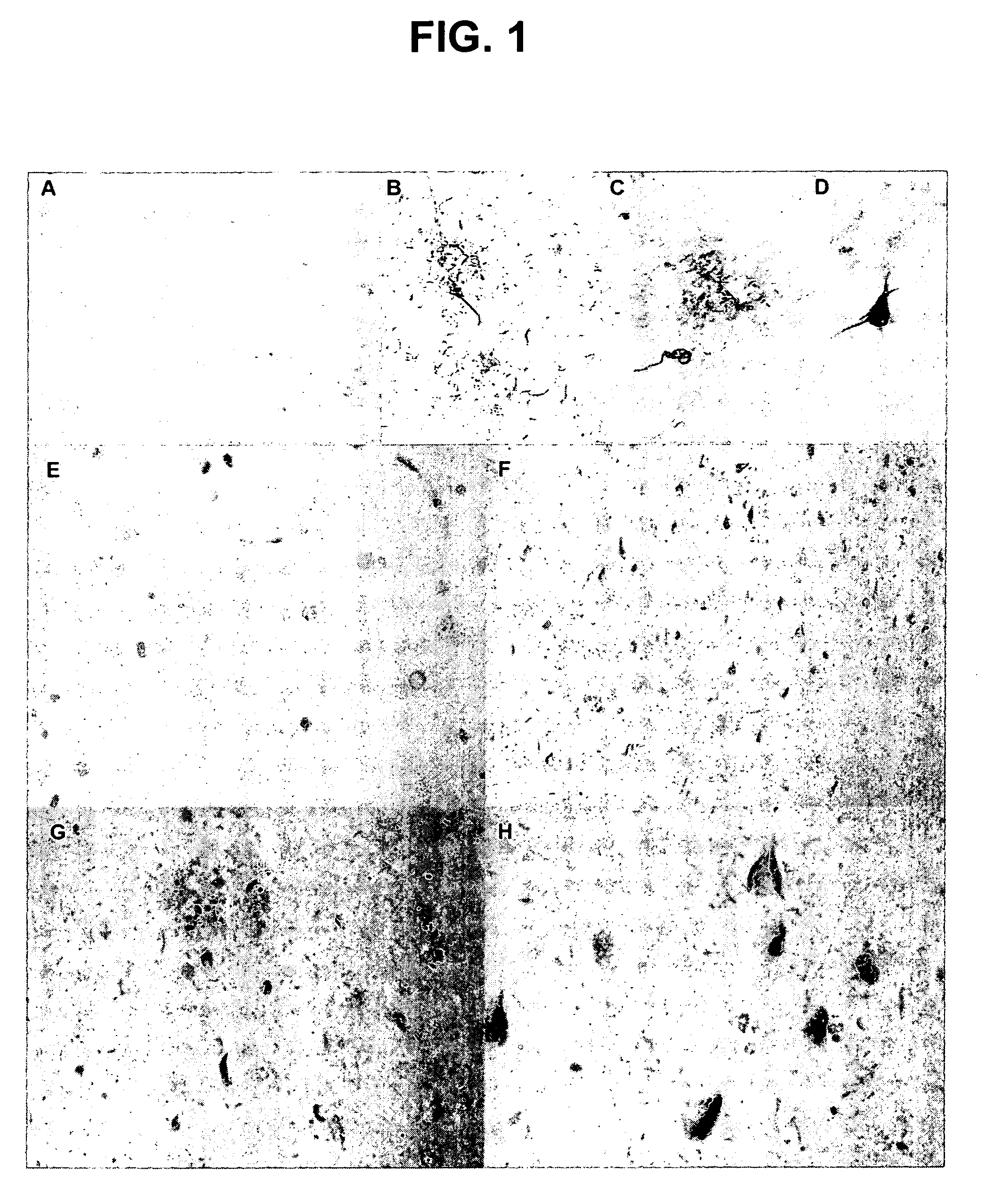 Phosphorylation of tau by abl