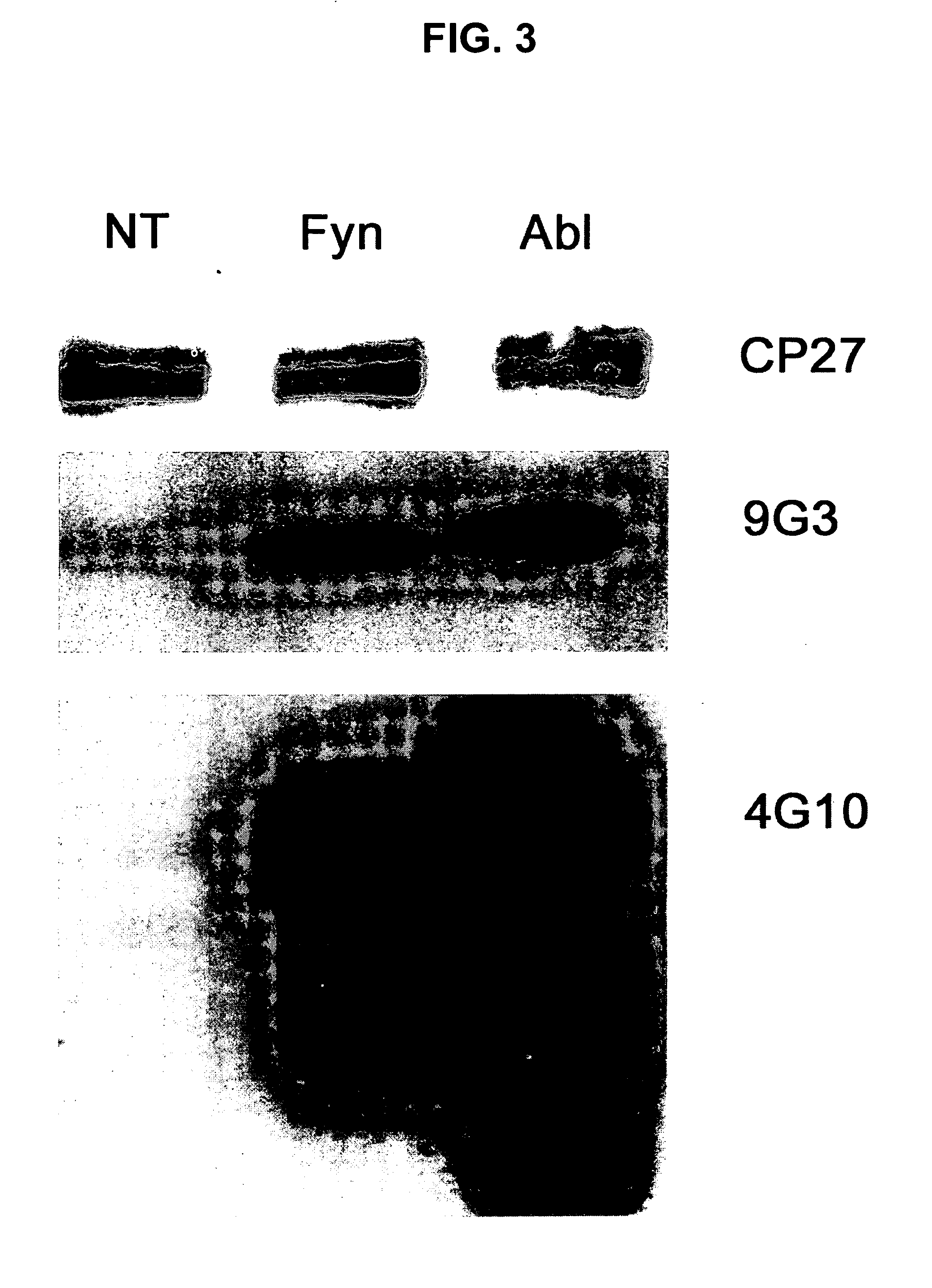 Phosphorylation of tau by abl