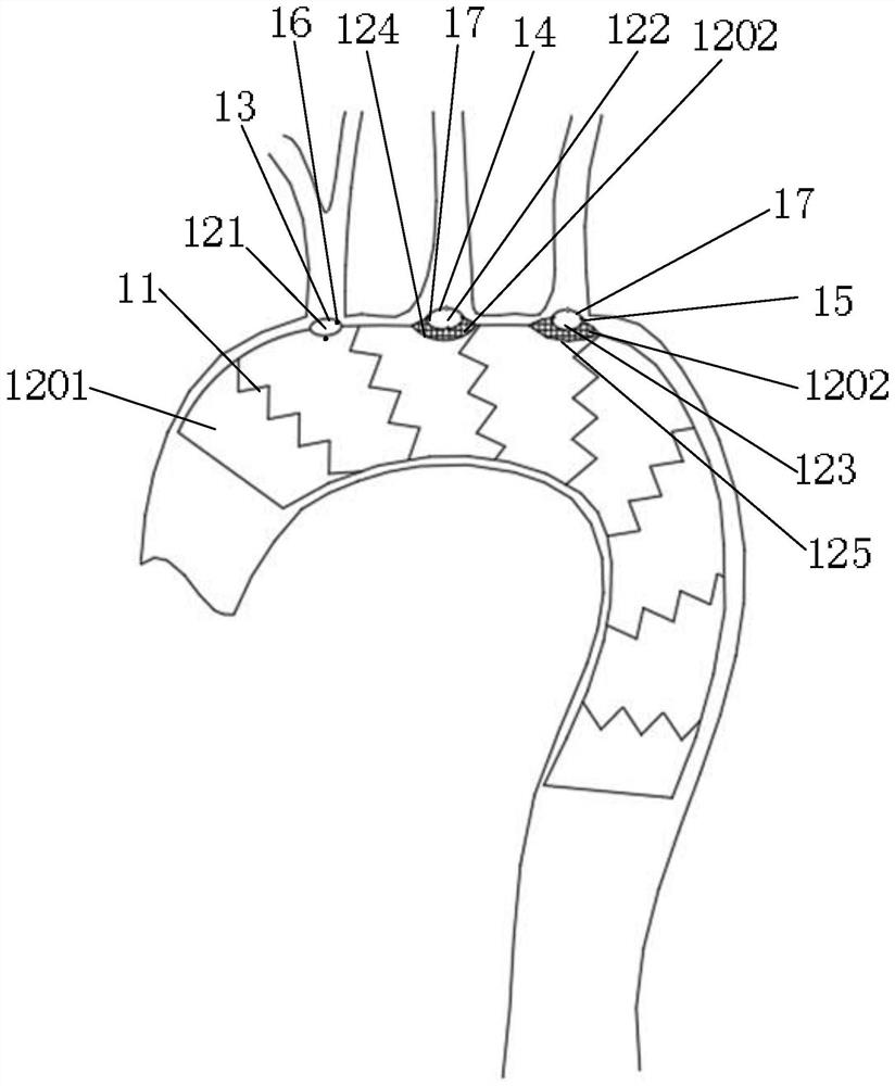 Aortic arch covered stent graft and its delivery device