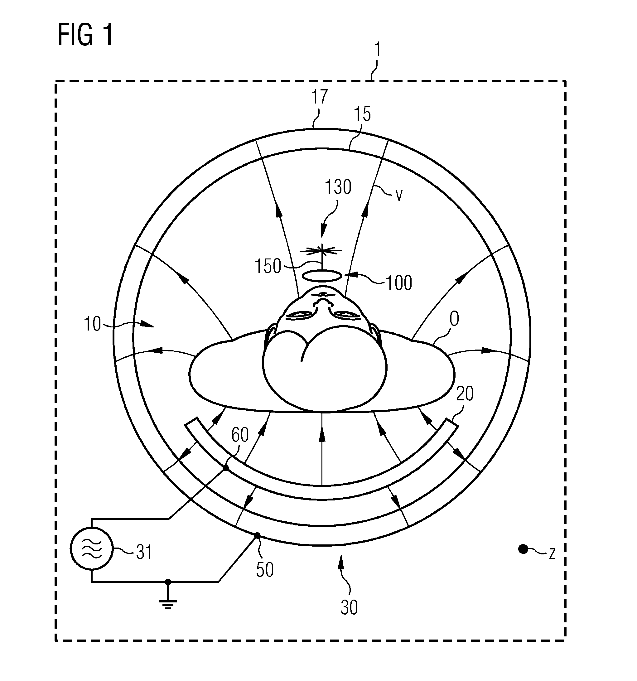 Local Coil for a Magnetic Resonance Imaging System and Magnetic Resonance Imaging System