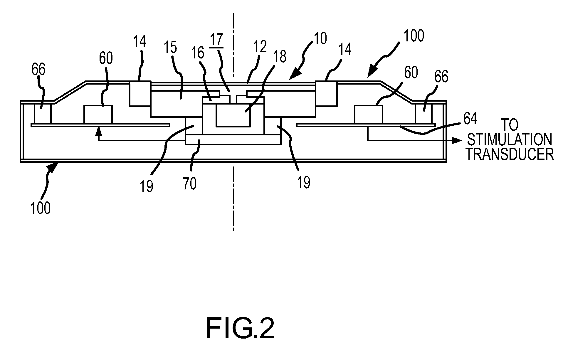 Dual feedback control system for implantable hearing instrument