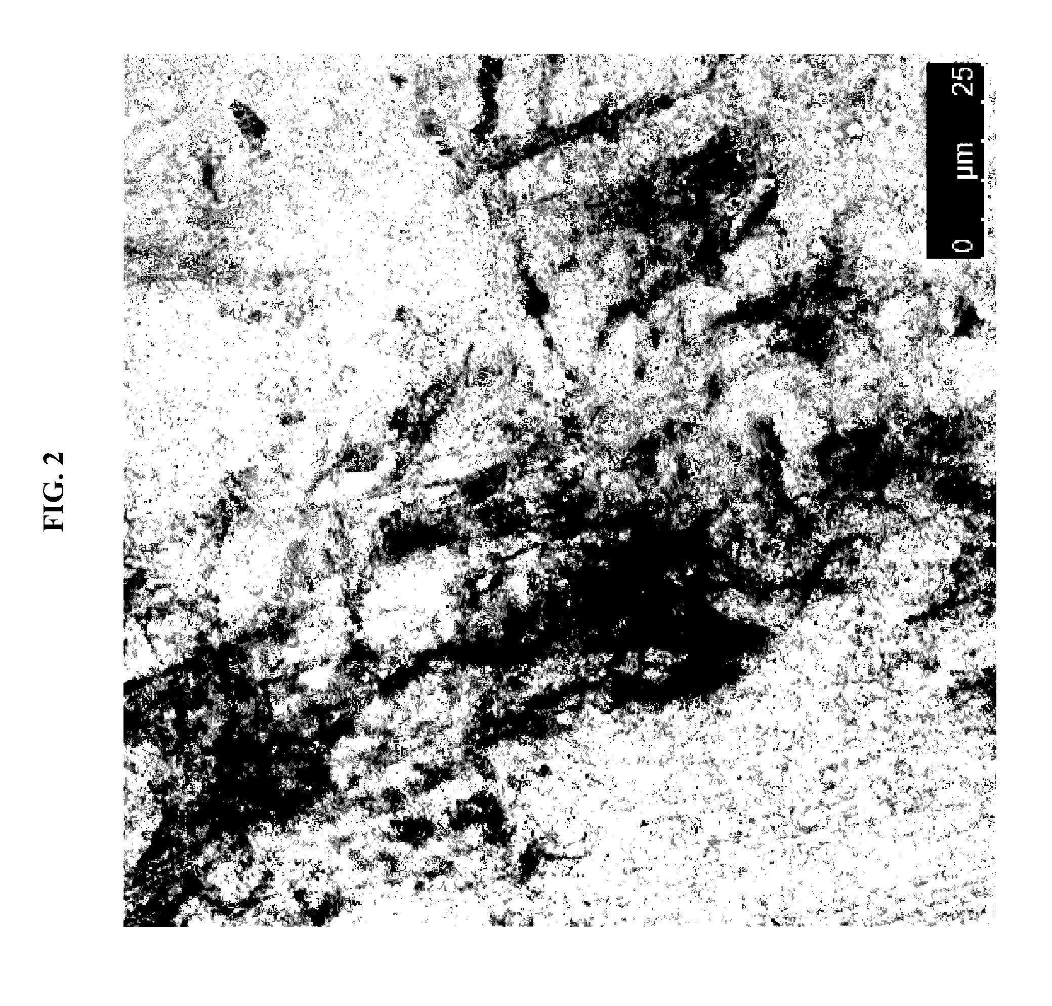 Cardiac fibroblast-derived extracellular matrix and injectable formulations thereof for treatment of ischemic disease or injury