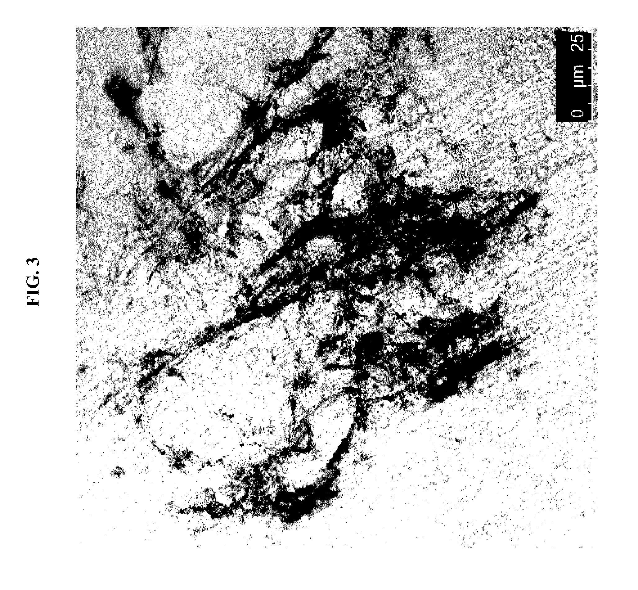 Cardiac fibroblast-derived extracellular matrix and injectable formulations thereof for treatment of ischemic disease or injury