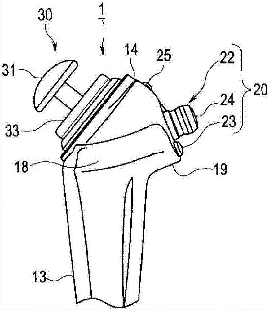 Endoscope