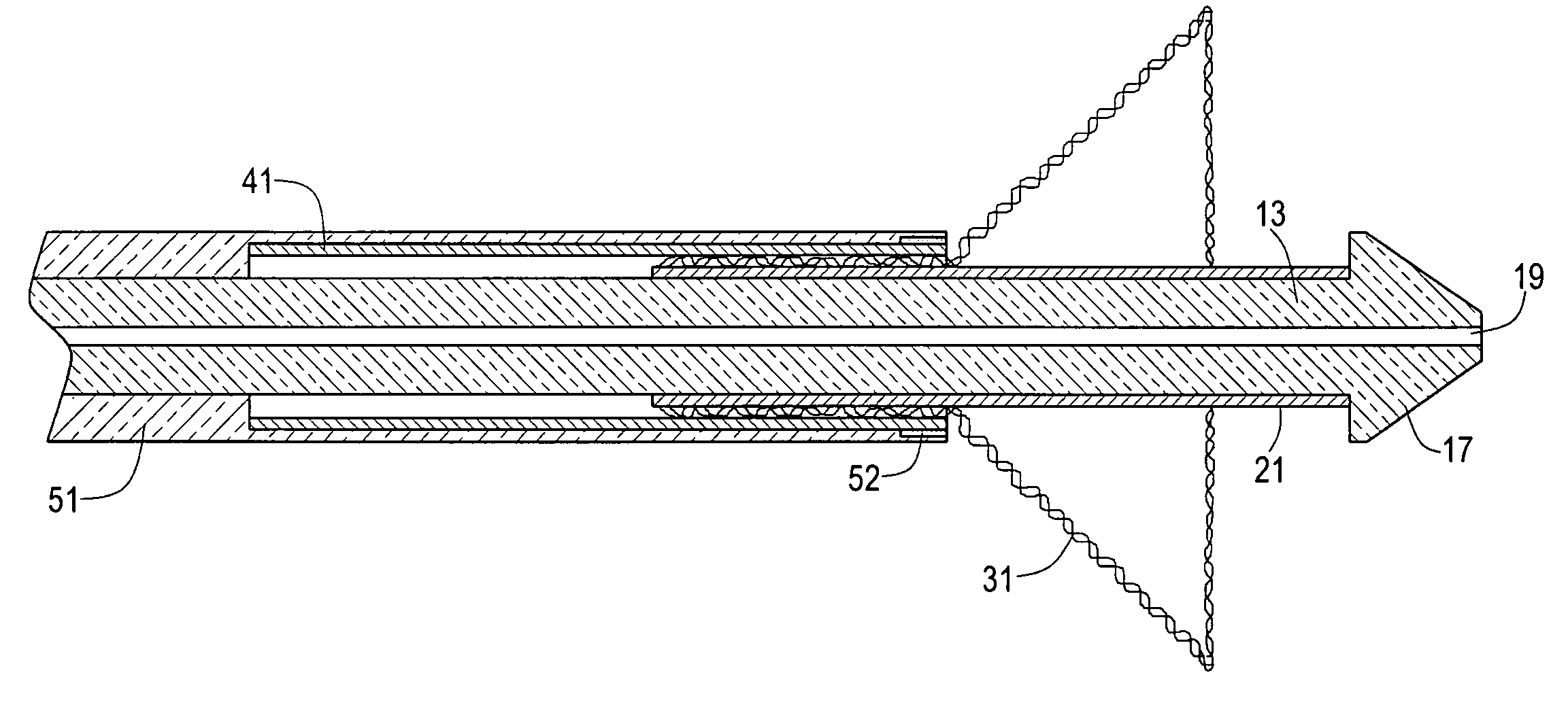 Method of manufacturing a stent delivery system