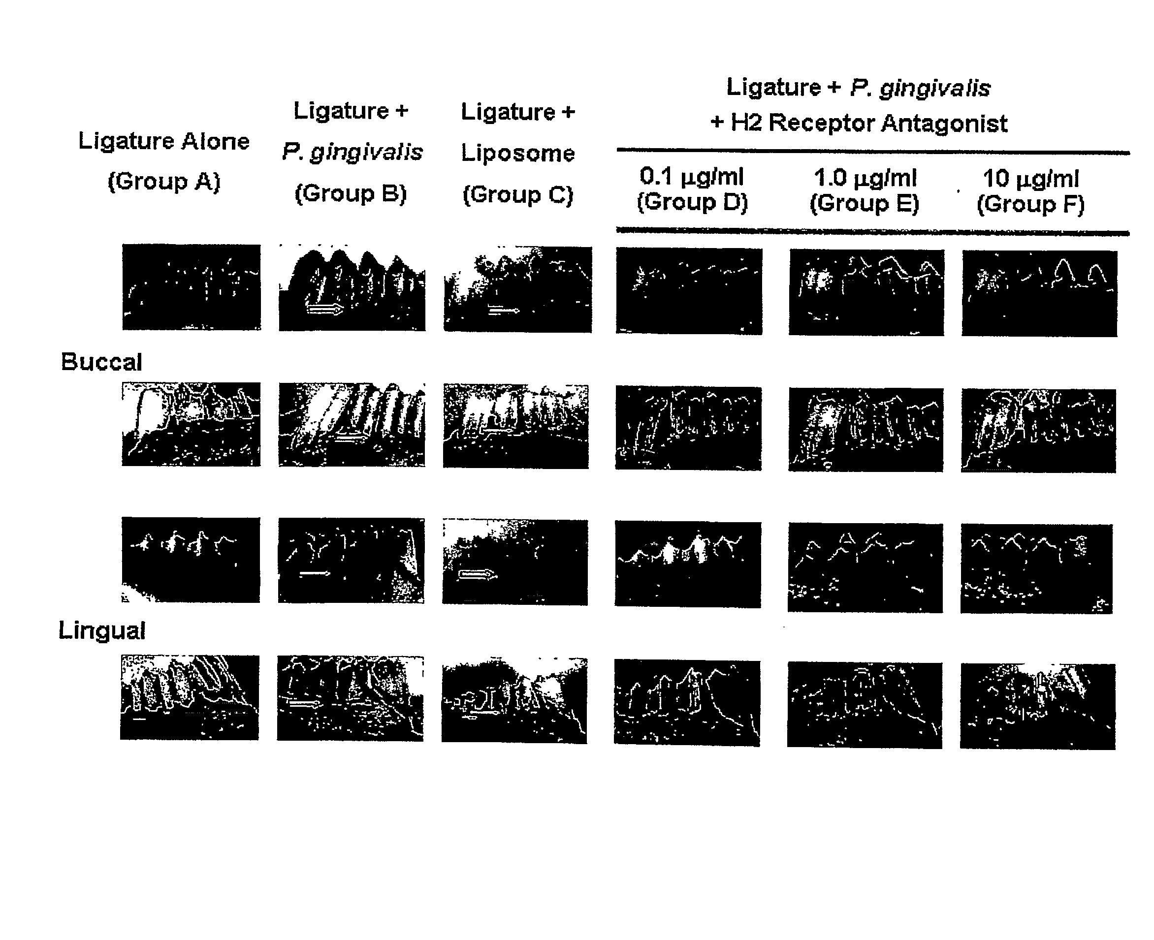 Delivery of H2 Antagonists