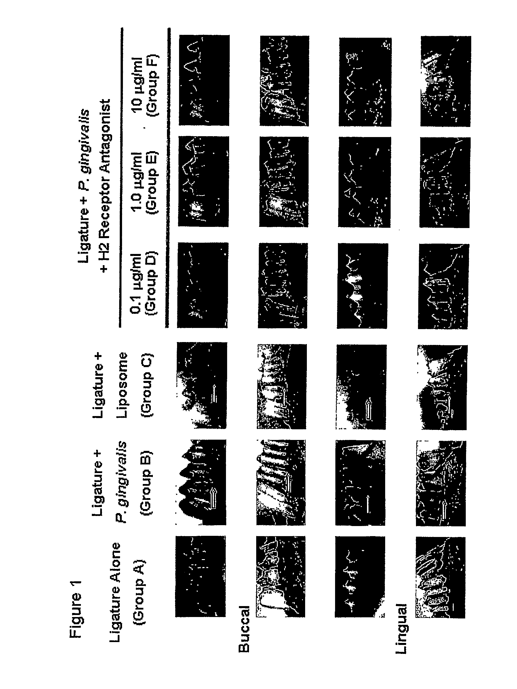 Delivery of H2 Antagonists