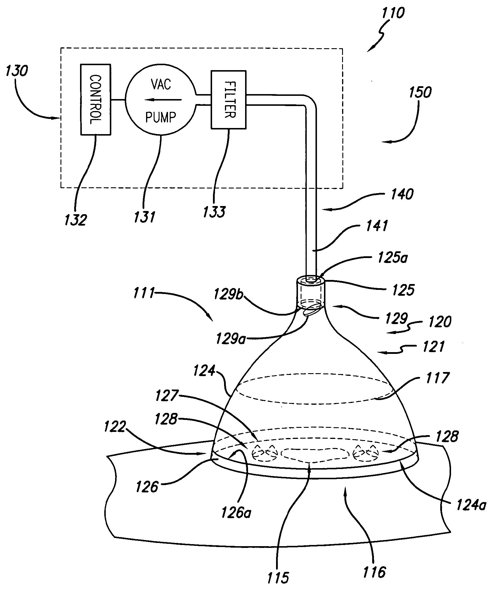 Reduced pressure wound treatment system