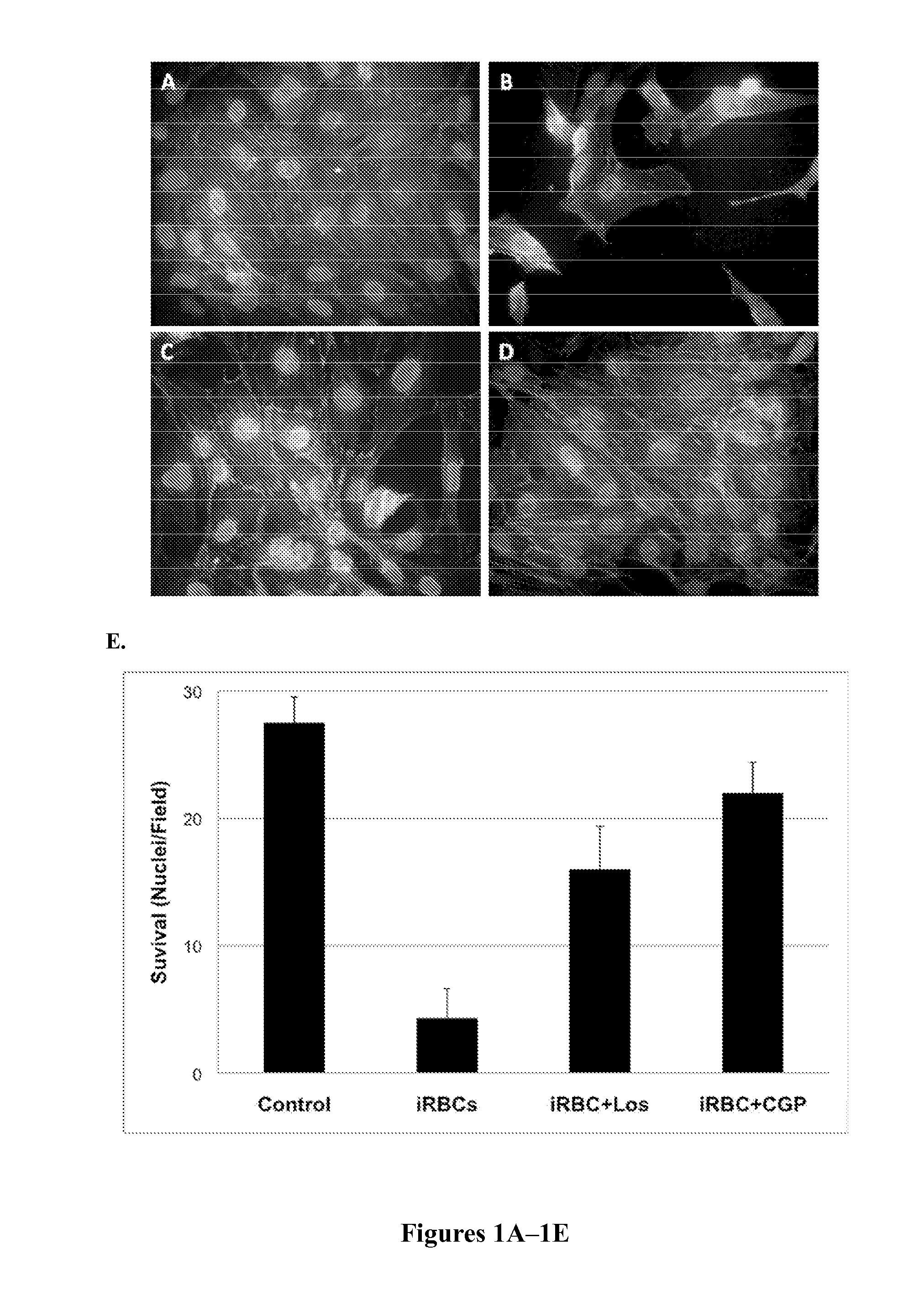 Modulation of angiotensin ii receptors for the prevention and treatment of malaria cerebral