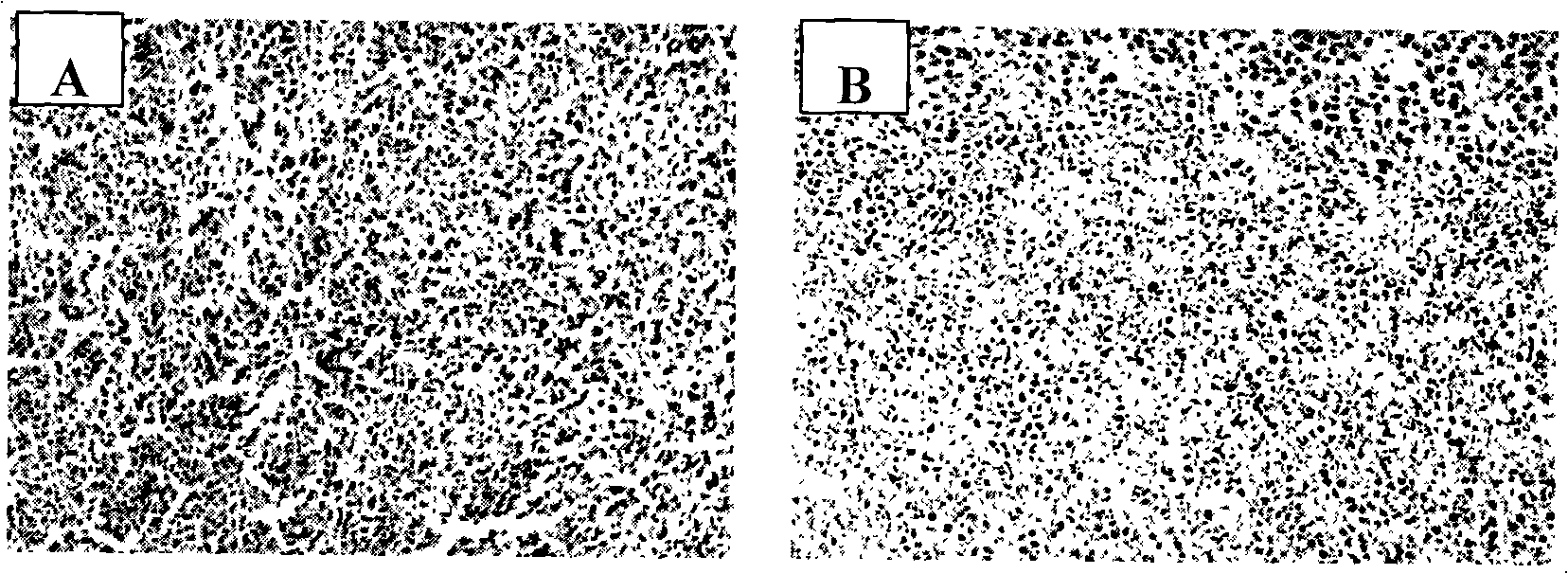 Use of human midkine protein blocking peptide in preparation of antitumor medicament