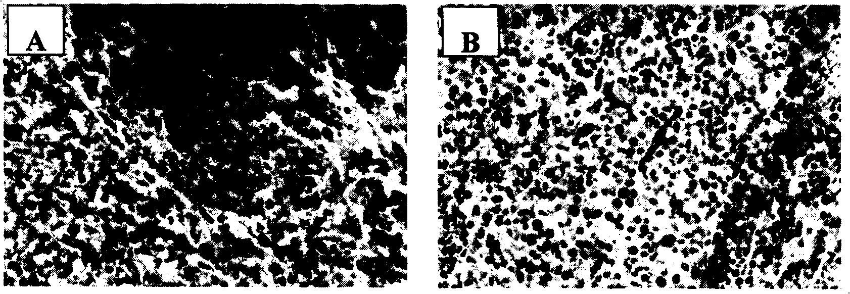 Use of human midkine protein blocking peptide in preparation of antitumor medicament