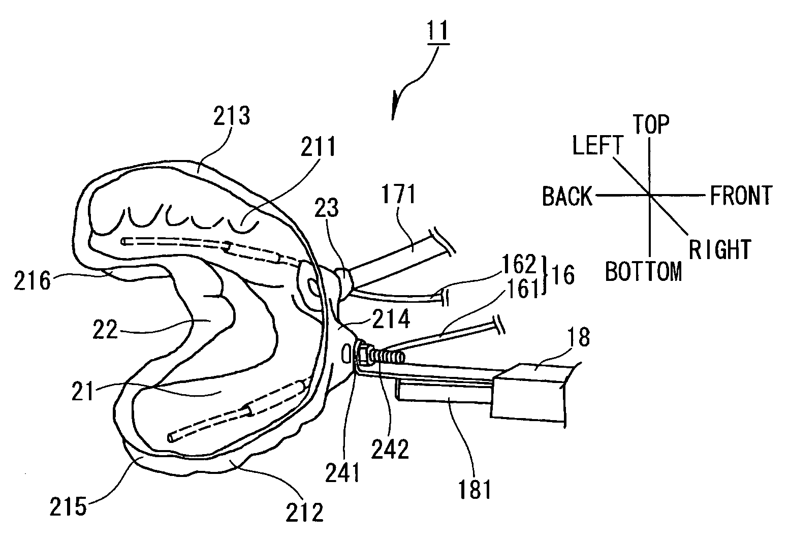 Dental system and method of producing the same