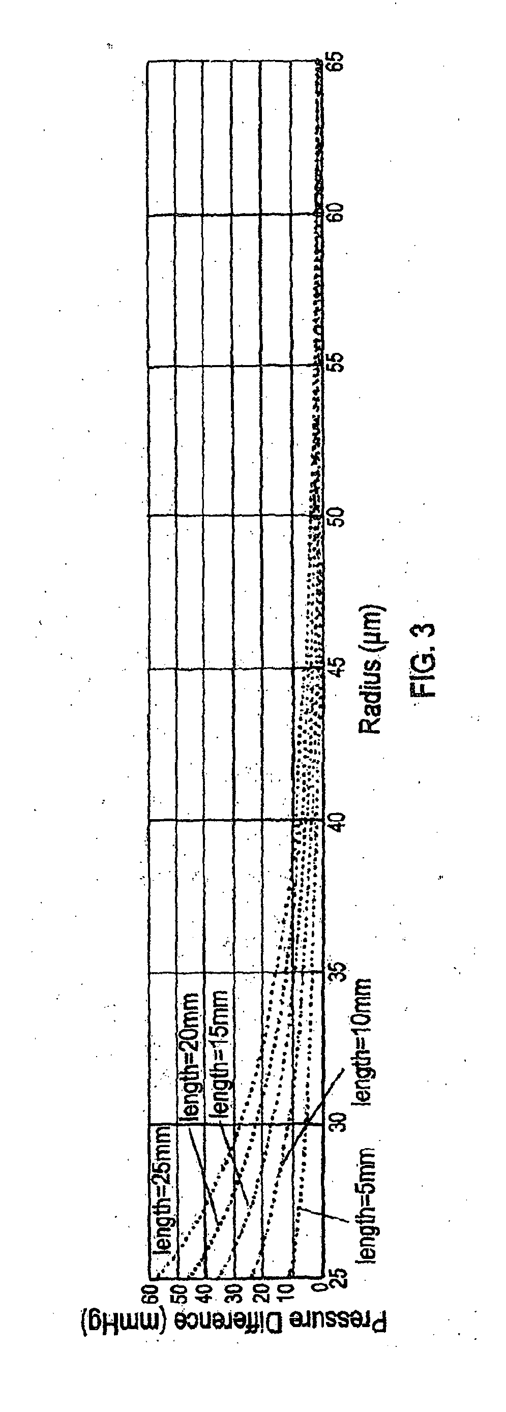 Partially degradable stents for controlled reduction of intraocular pressure