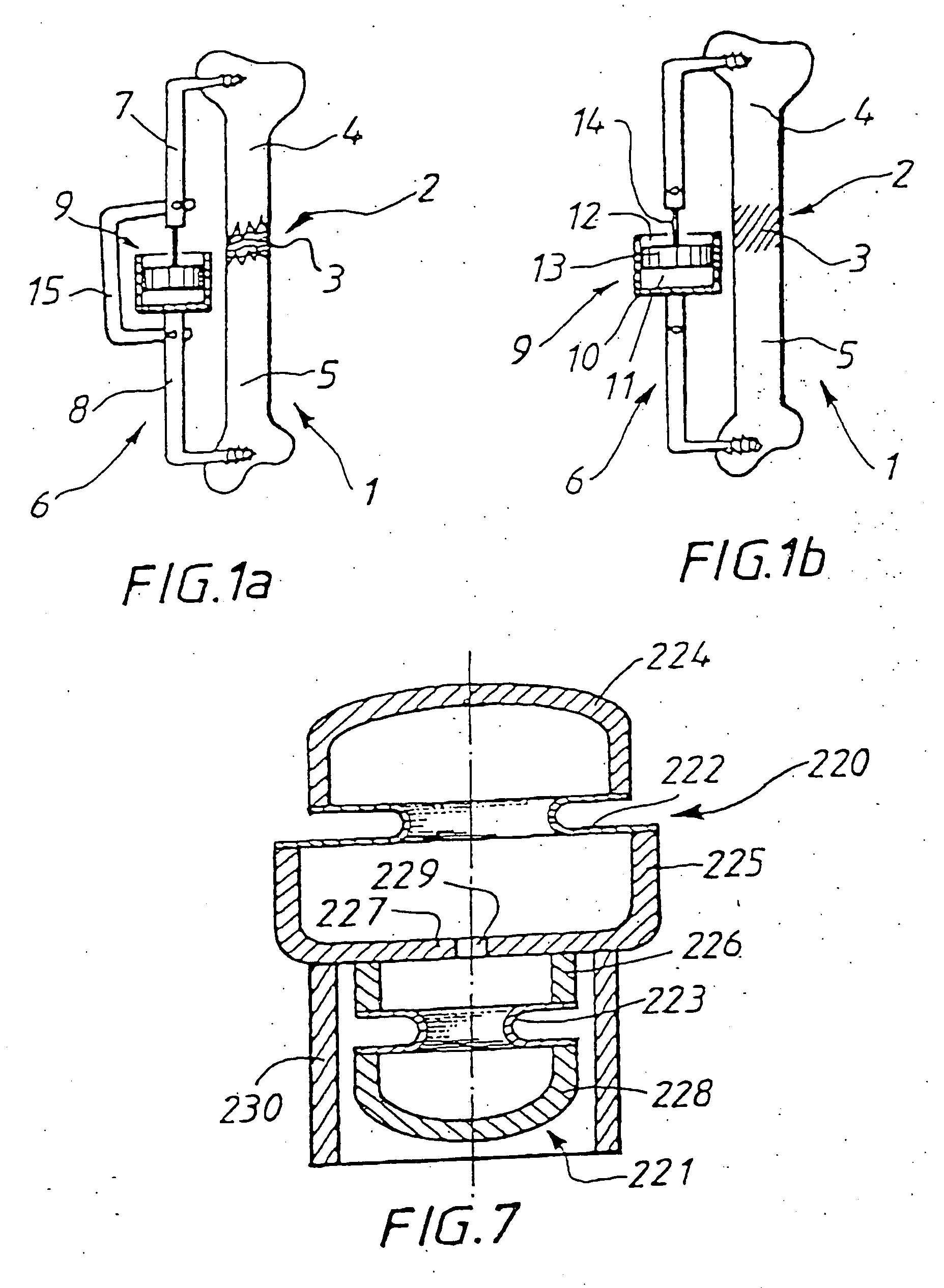 Skeletal implant